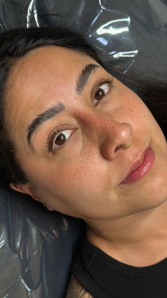 Micropigmentación Pecas