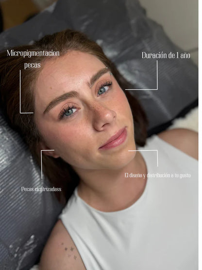 Micropigmentación Pecas